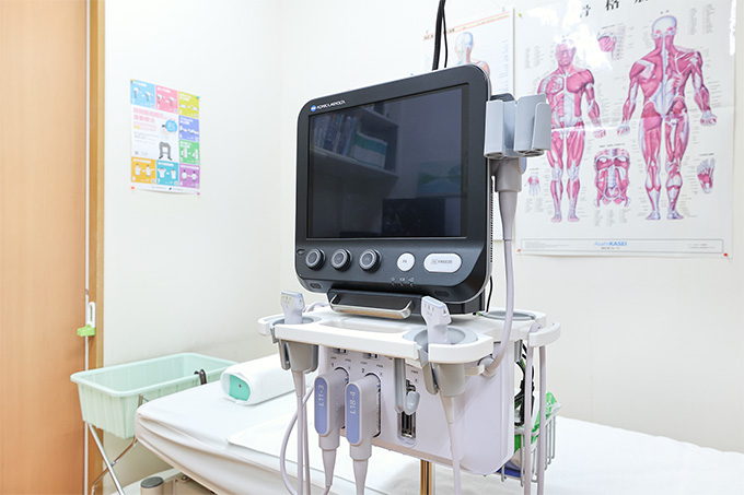 超音波診断装置